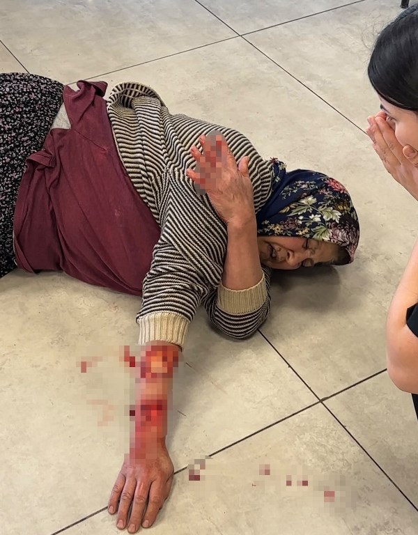 Afyon’da Tekmelere Aldırmayan Köpek Kadının Kolunu Kopardı!