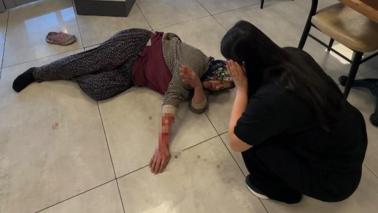 Afyon’da Tekmelere Aldırmayan Köpek Kadının Kolunu Kopardı!