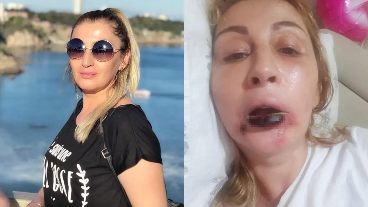 Güzelleşmek isterken hayatı karardı!
