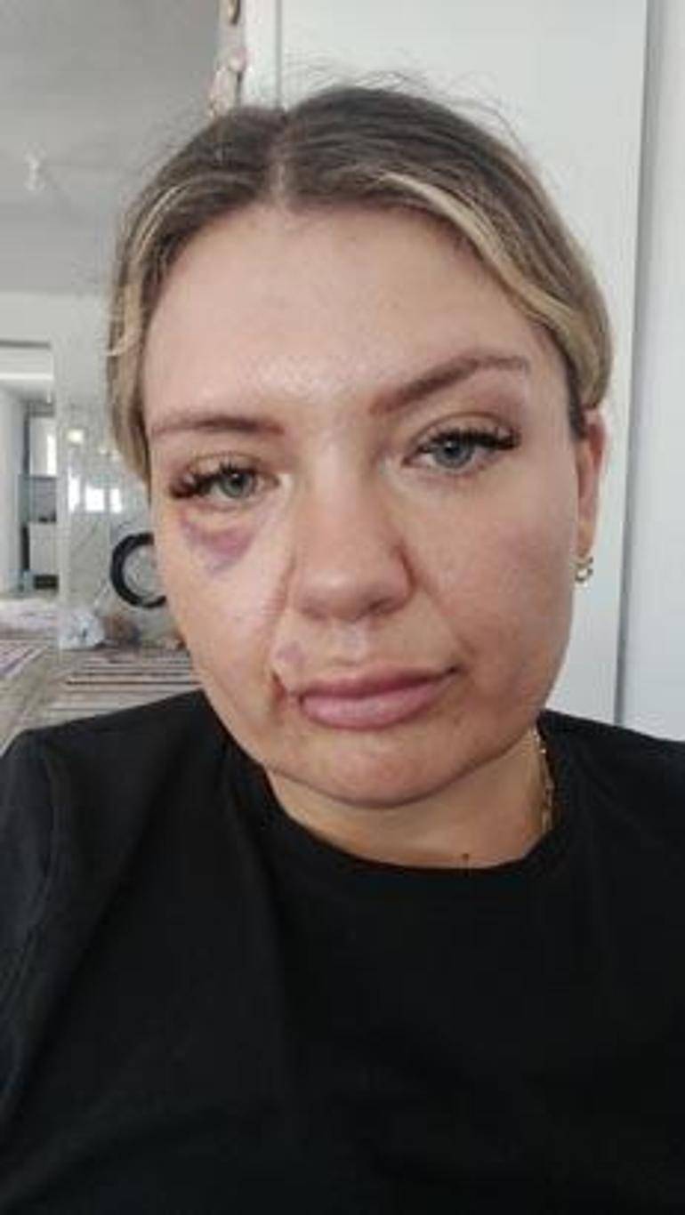 Antalya'da Korkunç Saldırı! Eski Erkek Arkadaşının Bıçağı Sırtında Kırıldı